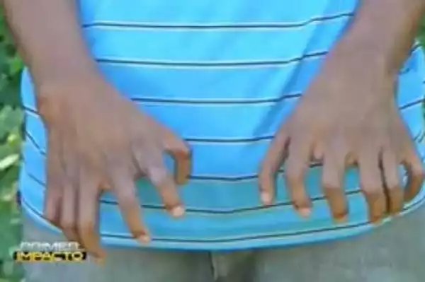 Unbelievable! Meet the Teenage Boy Called Born with 26 Fingers and Toes (Photos)